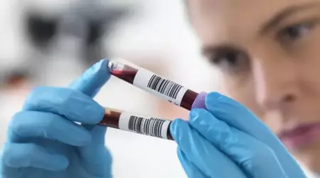 Chinese scientists create AI blood test that diagnoses diseases 15 years before symptoms appear