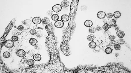 Australian lab missing dangerous viruses due to freezer failure