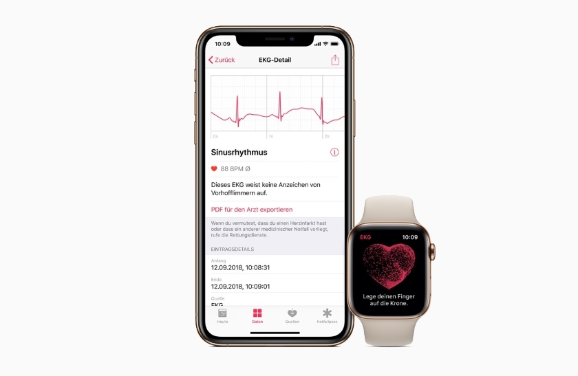 В Європі з оновленням watchOS 5.2 для Apple Watch 4 додали підтримку ЕКГ