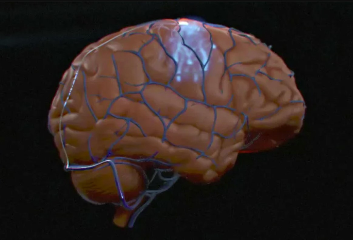 Synchron is the first to implant a human brain-computer interface in the United States