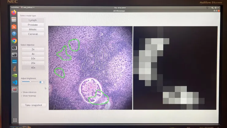 Google et le Pentagone ont mis au point un microscope basé sur l'intelligence artificielle pour le diagnostic du cancer-3