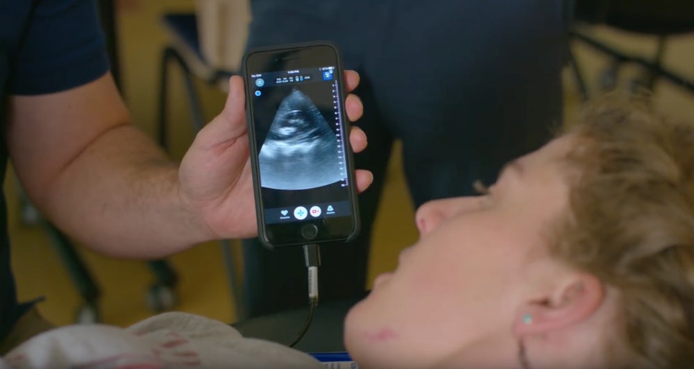 portable-ultrasound-butterfly-iq-6.jpg